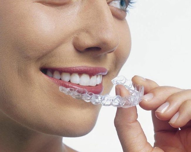 Q&M Dental Clinic - Tangkak (Invisalign Braces Provider) 1 qm dental clinic tangkak invisalign braces provider
